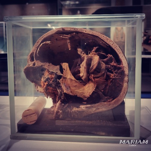 Photographie d'une coupe transversale d'un crâne momifié exposée au Musée de la Momification de Louxor, montrant la cavité crânienne vidée de son cerveau et comblée avec du lin ou de la résine.