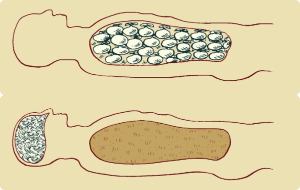 Illustration didactique du processus de momification égyptienne montrant le rembourrage du corps avec de la sciure, des feuilles et du lin pour lui redonner un aspect naturel, après que les organes déshydratés ont été enveloppés et replacés à l'intérieur.